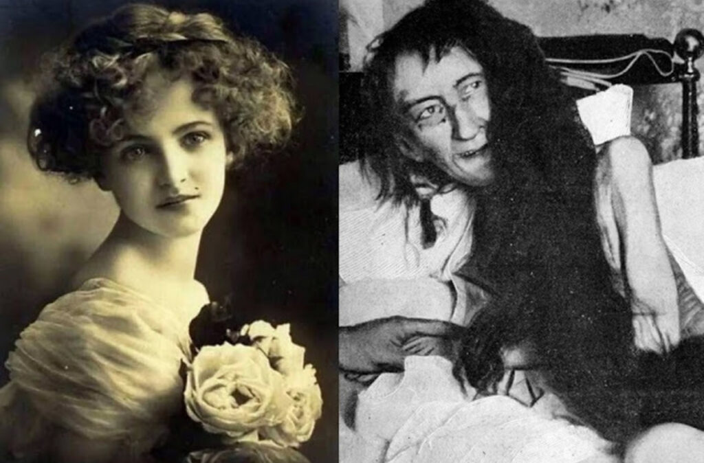 Hidden Horrors Unveiled: The 25-Year Confinement of Blanche Monnier ...